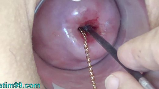 Extreme Cervix Play Free Videos - Watch, Download and Enjoy Extreme Cervix Play
