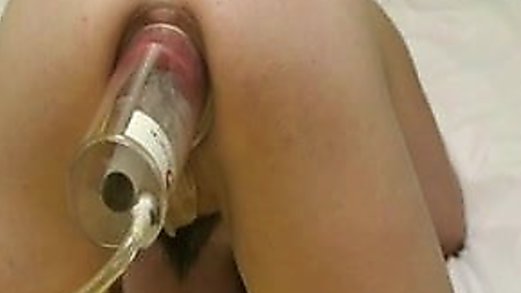Woman Sucking Prolapse Men Free Videos - Watch, Download and Enjoy Woman Sucking Prolapse Men